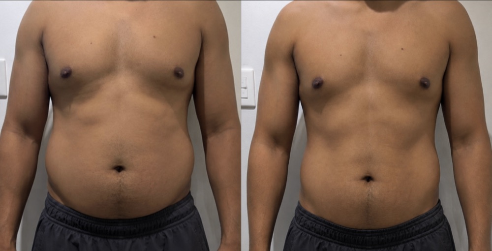 Transformación de Andrés, 10kg menos