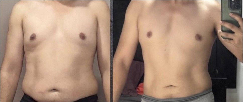 Transformación de Emilio, 4 semanas dentro del programa