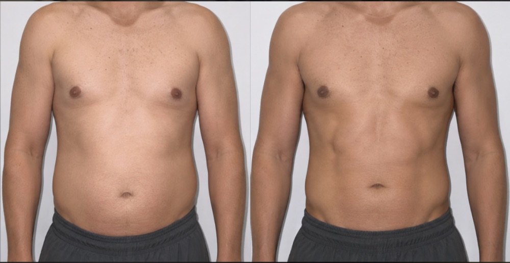 Transformación de Fer, 9kg menos