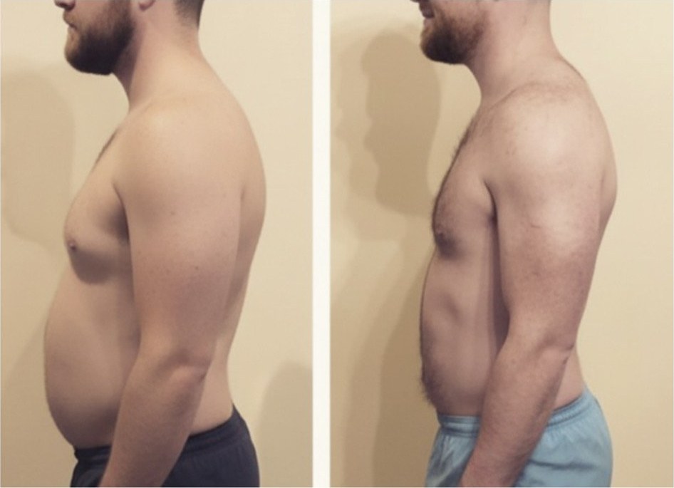 Transformación de Juan, 8kg perdidos + masa muscular