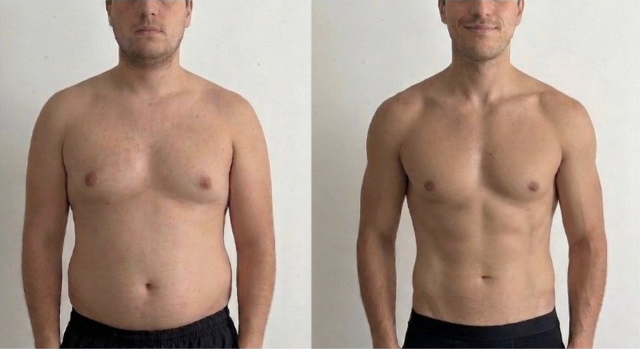 Transformación de Miguel, 12kg menos, recomposición corporal