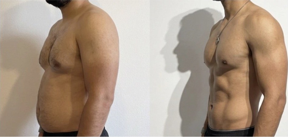 Transformación de Rodrigo, 10kg perdidos + tonificación